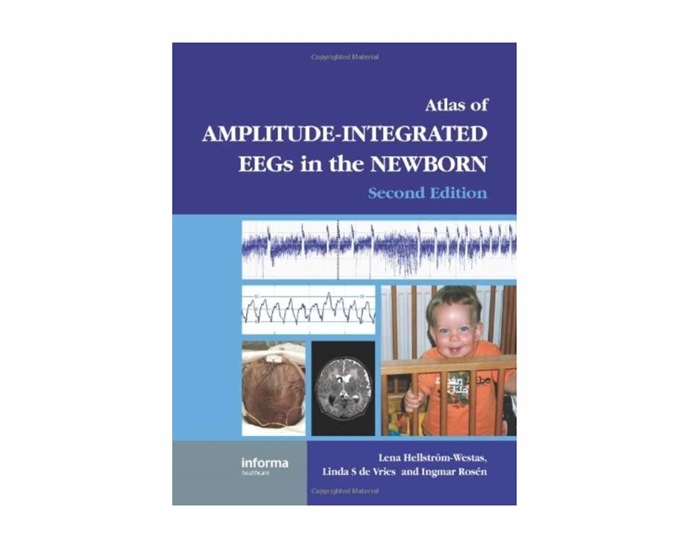 The Book "An Atlas of aEEG in the Newborn" 2 edition.